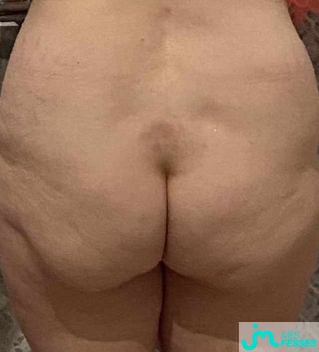 fesses de Bi86
