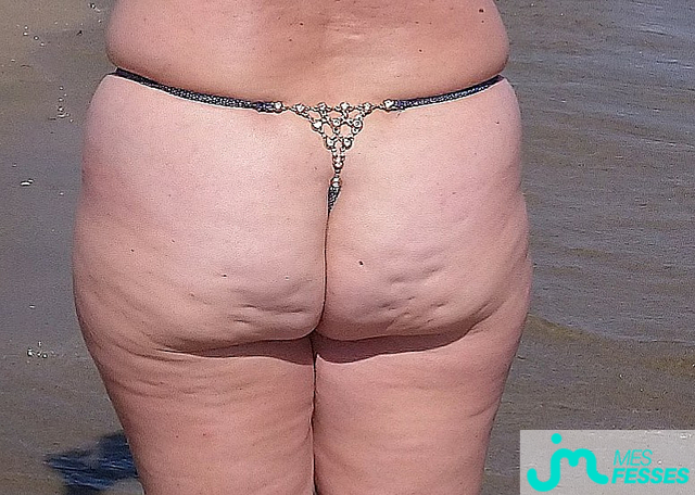 fesses de Chouchou75