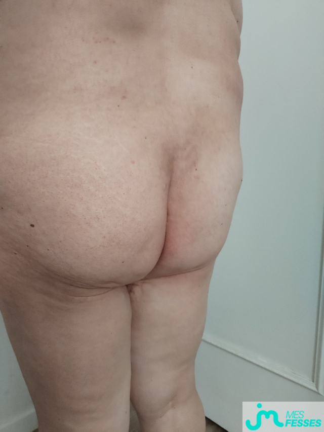 Photos de fesses : J'aime pas mes fesses et vous ? 
