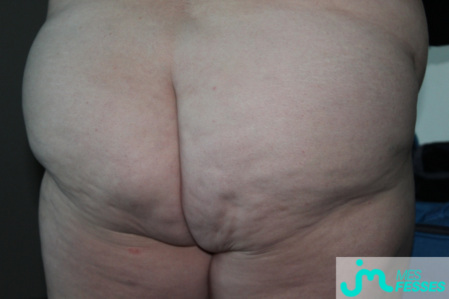 fesses de babymauve